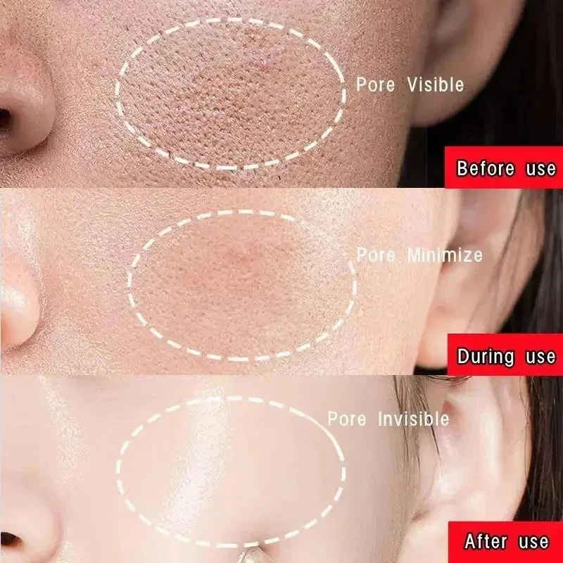 Original Facial Remove Blackhe - Bentonite Clay Mask ulasan dan harga