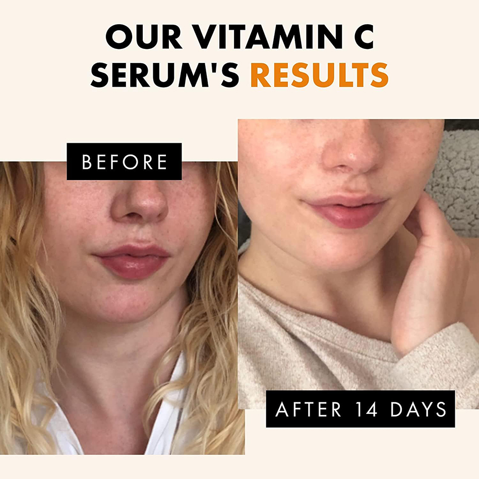 120ml 99% Vitamin C Serum Oil  - Snail Mucin Essence ulasan dan harga